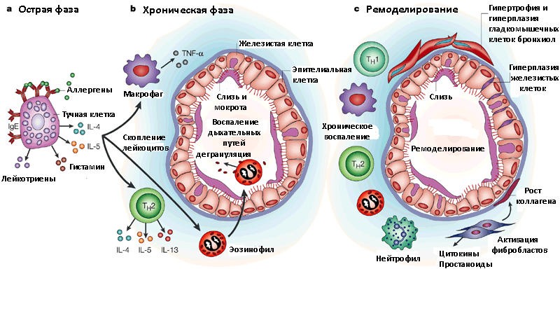 патогенез бронхиальной астмы