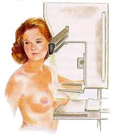 маммография при узлах в груди