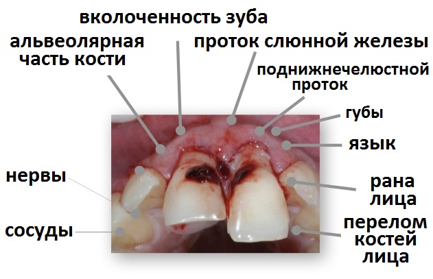 стоматологический осмотр при челюстно-лицевой травме