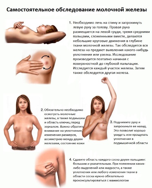 принципы самостоятельного обследования груди